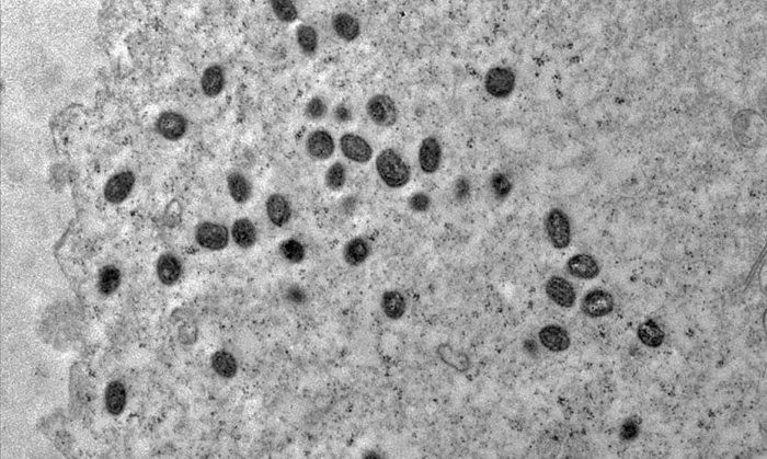 Mpox: Argentina põe em quarentena navio que deixou Brasil 1 Mpox